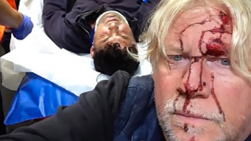 Calais : Trois journalistes anglais violemment attaqués par des clandestins