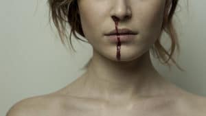 Joies du multiculturalisme : à Besançon, on rase gratis dans les médias