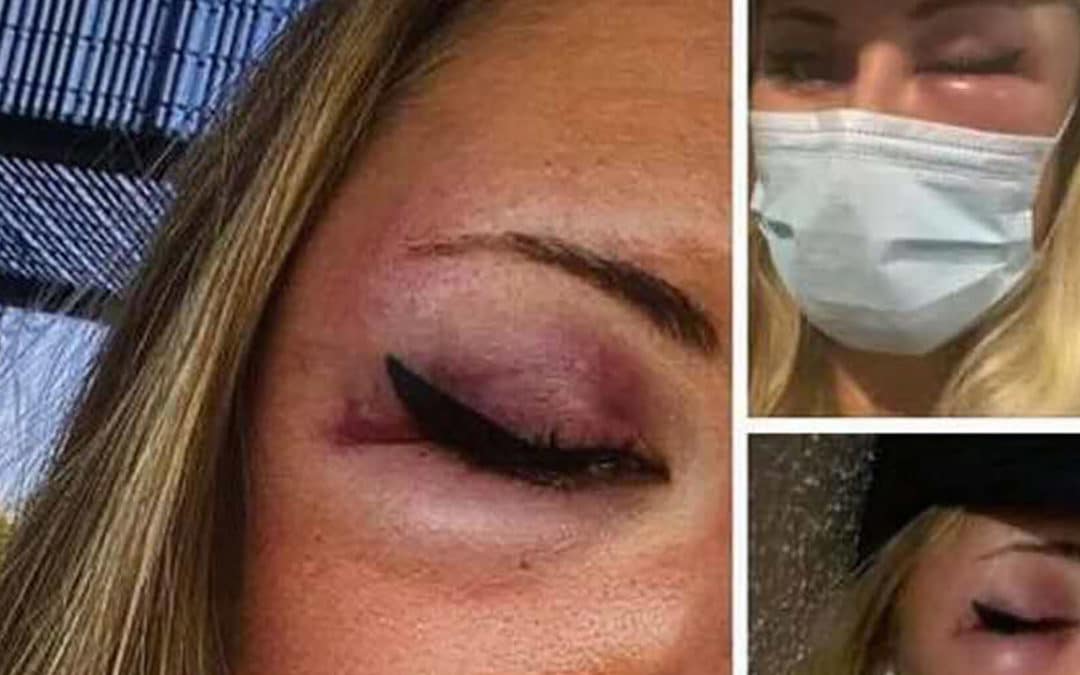 Agression d’une jeune femme habillée en jupe à Strasbourg : “un fait divers malheureux”