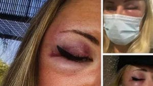 Agression d’une jeune femme habillée en jupe à Strasbourg : "un fait divers malheureux"