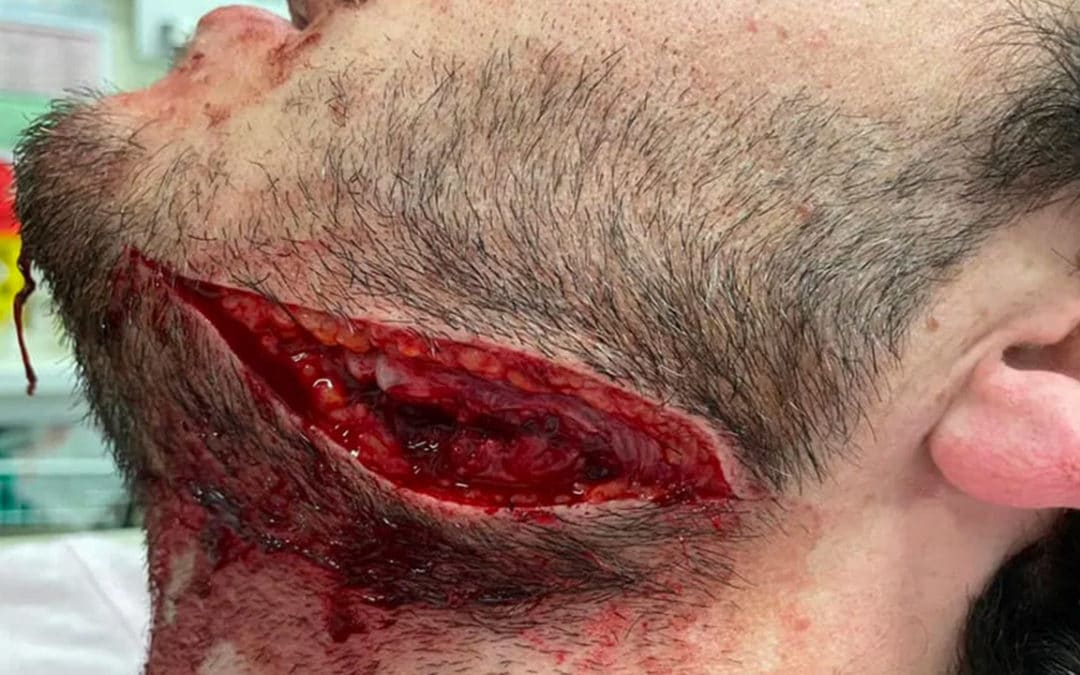 Comme à Reims, une agression sauvage mais très discrète à Bordeaux