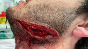 Comme à Reims, une agression sauvage mais très discrète à Bordeaux